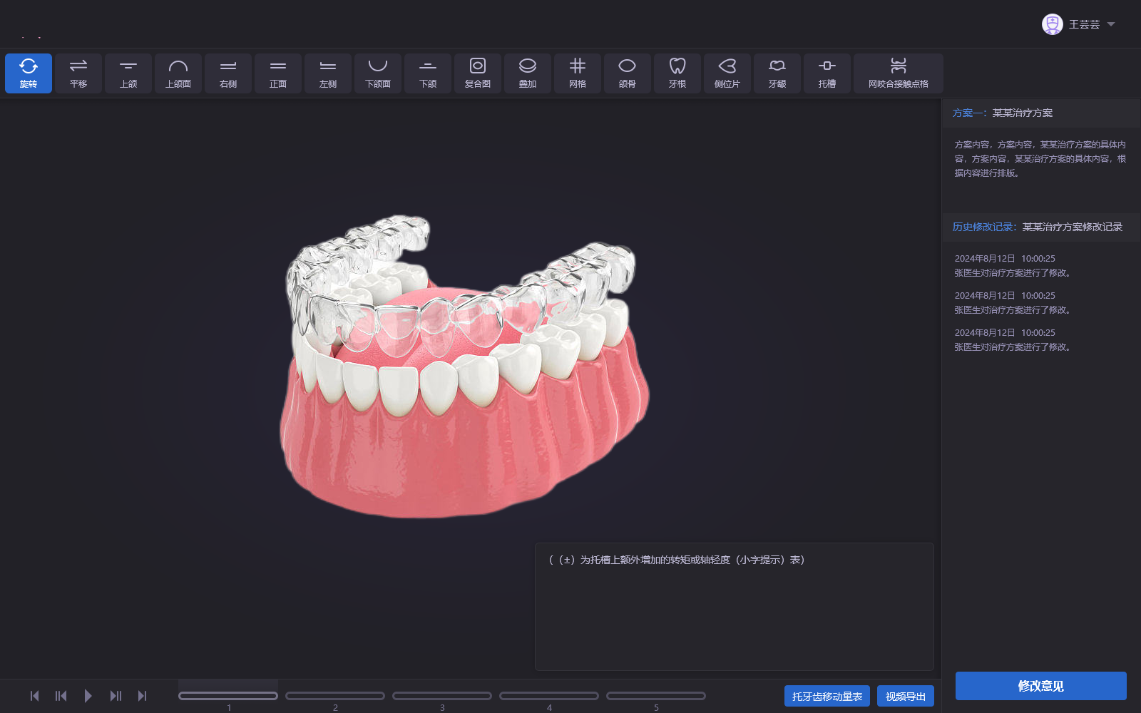 数字化口腔正畸 3D 排牙方案设计平台
